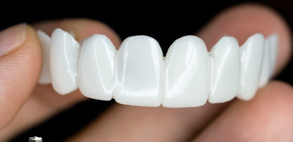 Tandenbeugel set – op maat – witte esthetiek – voor mooie glimlach