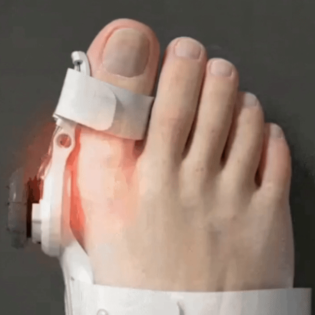 Fittershape Bunion Corrector – verstelbaar voor pijnverlichting