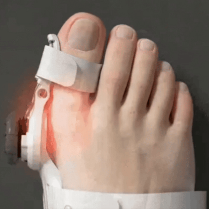 Fittershape Bunion Corrector – verstelbaar voor pijnverlichting