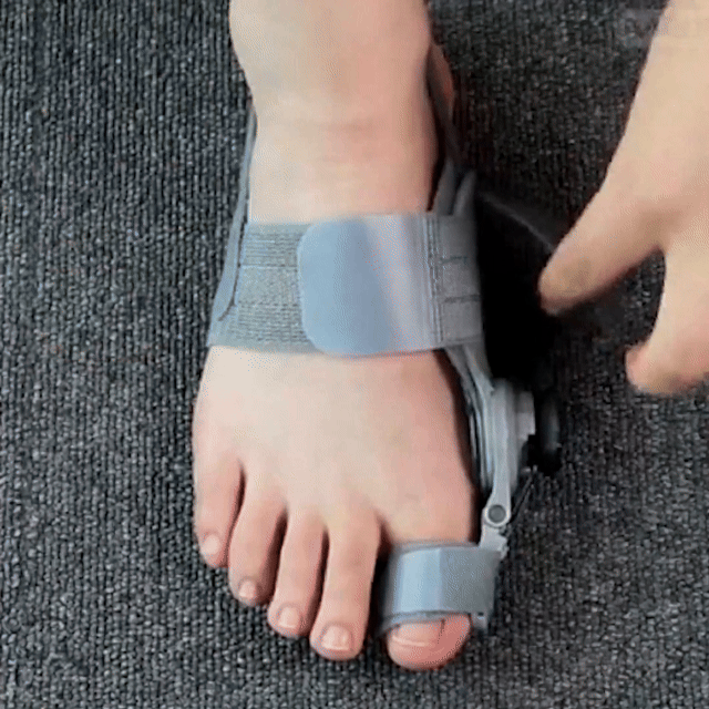 Fittershape Bunion Corrector – verstelbaar voor pijnverlichting