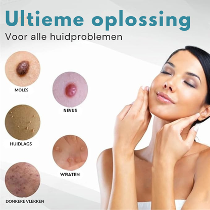 Huidverzorgingsapparaat – Verwijder Moedervlekken, Wratten en Huidflapjes
