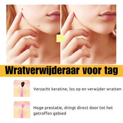 Bijenwesp Extract Verwijderaar – Voor Moedervlekken en Wratten – Ontstekingsremmend