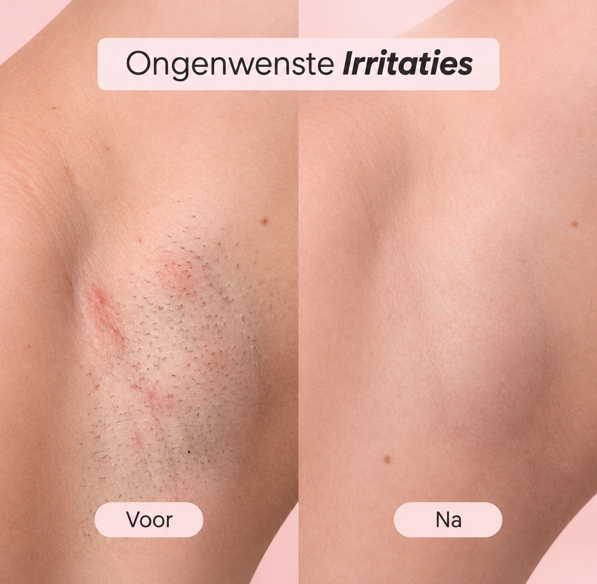 Fittershape 5-in-1 Scheerapparaat – waterproof & voor gevoelige huid