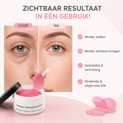 Fittershape Hydrogel Oogmaskers – tegen wallen & donkere kringen