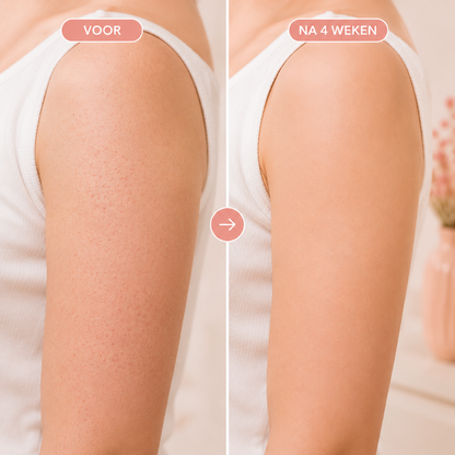 Fittershape Triple-Acid Complex – tegen keratosis pilaris