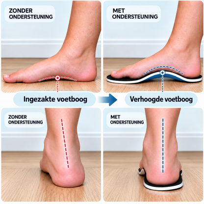Fittershape ErgoSteg Zolen – versterkte voetboogondersteuning