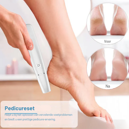 Voetvijl – Oplaadbaar – Verwijdert eelt – Voor zachte voeten