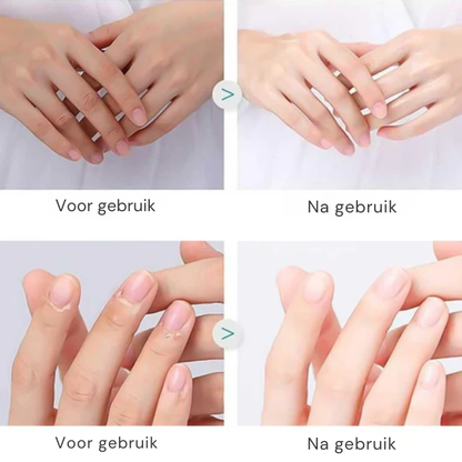 CareClip Nail Tool – Veilige Pijnloze Nagelverzorging Met Eén Klik