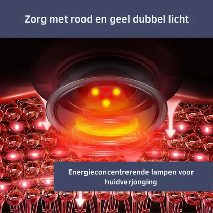 SmartCupping Massager – Elektrisch Cupping Massageapparaat Voor Spierrelief