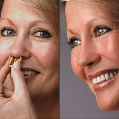 SilentBreath Nose Clip – Anti-Snurk Neusclip Voor Vrije Ademhaling