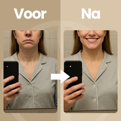 Fittershape GlowFusion Tool | 6-in-1 Gezichtsversteviger – Voor Strakkere Huid