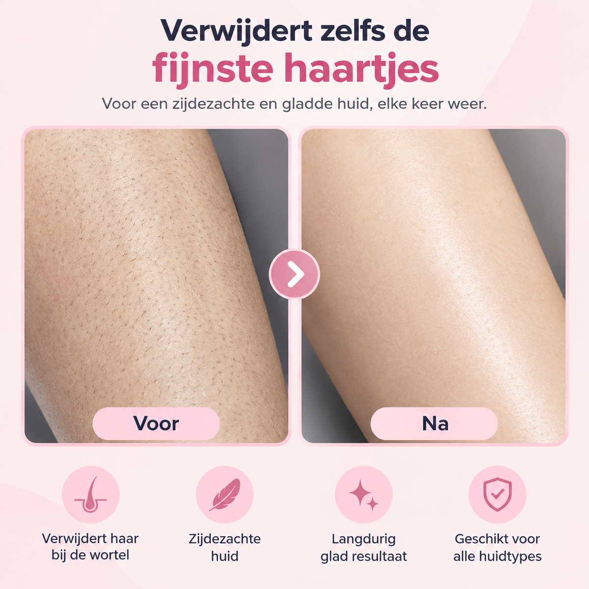 Fittershape 5-in-1 Scheerapparaat – waterproof & voor gevoelige huid
