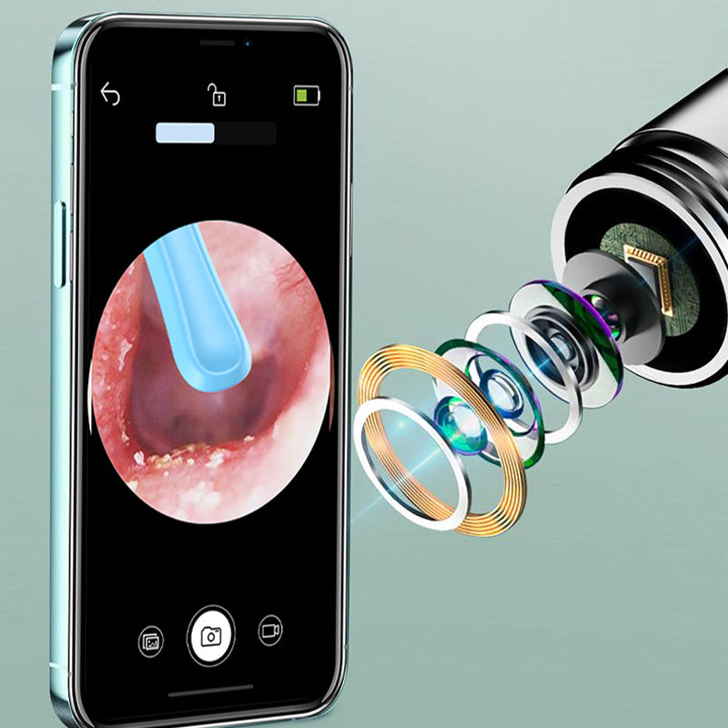 Oorreiniger – Draadloos – Camerafunctie – Voor oorreiniging